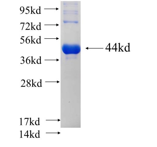 Recombinant human ARHGAP25 SDS-PAGE