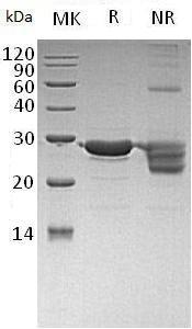 Human DR1 (His tag) recombinant protein