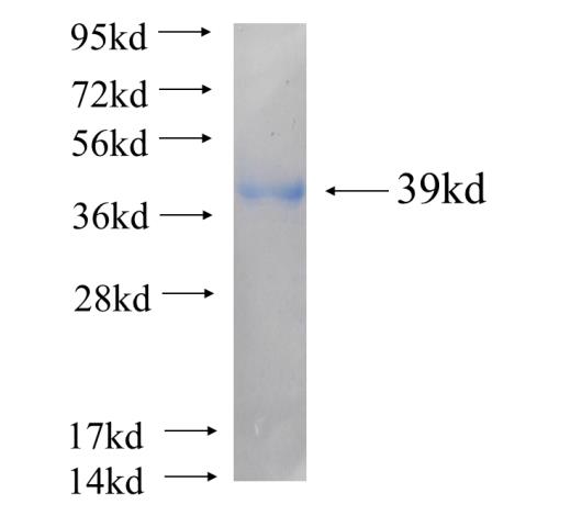 Recombinant human LAMR1,RPSA(Full length) SDS-PAGE