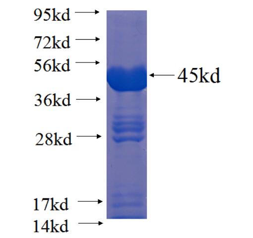 Recombinant human DHX15 SDS-PAGE