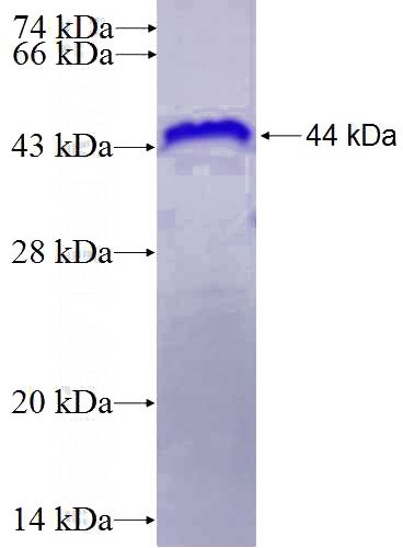 Recombinant Human YY2 SDS-PAGE