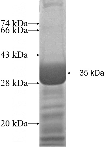 Recombinant Human SYF2 SDS-PAGE