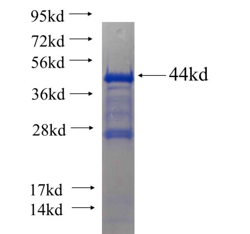 Recombinant human RBM16 SDS-PAGE