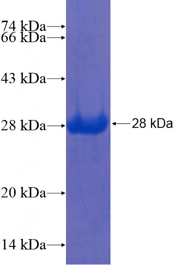Recombinant Human PLAA SDS-PAGE