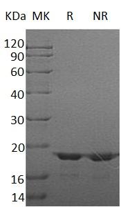 Human LGALSL/GRP/HSPC159 (His tag) recombinant protein