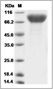 Rat CSF1R / MCSF Receptor / CD115 Protein (His Tag) SDS-PAGE