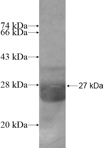 Recombinant Human RGS8 SDS-PAGE