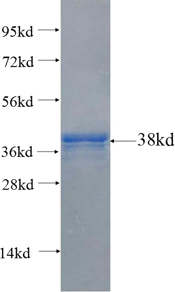 Recombinant Human NPC1L1 SDS-PAGE