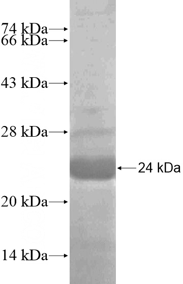 Recombinant Human COL4A5 SDS-PAGE