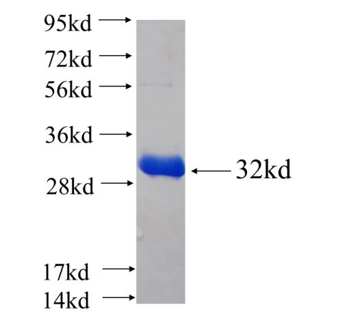 Recombinant human ZNF192 SDS-PAGE