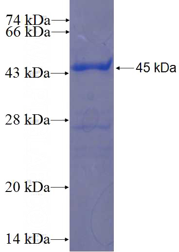 Recombinant Human KLHDC8A SDS-PAGE