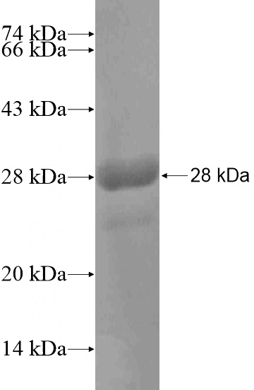 Recombinant Human FAM48A SDS-PAGE
