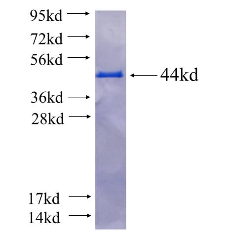 Recombinant human PLCD1 SDS-PAGE