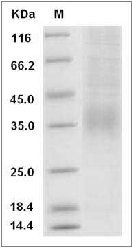 Rat 4-1BBL / CD137L / TNFSF9 Protein (His Tag) SDS-PAGE