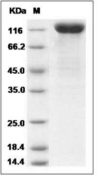 Rat LIFR Protein (His Tag) SDS-PAGE