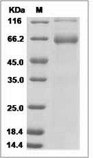 Human ITIH3 Protein (Fc Tag) SDS-PAGE