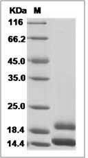 Human CCL2 / MCP-1 / MCP1 Protein (His Tag) SDS-PAGE