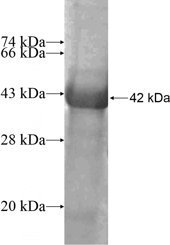 Recombinant Human SHPRH SDS-PAGE