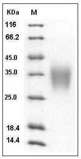Human ACVR2B / ActivinR-IIB Protein (His Tag) SDS-PAGE