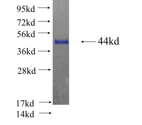 Recombinant human RNF181 SDS-PAGE
