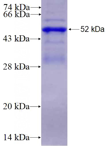Recombinant Human RNF125 SDS-PAGE