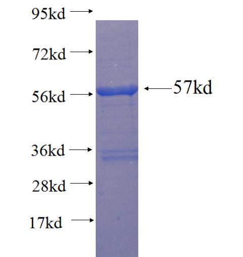 Recombinant human ACSF2 SDS-PAGE