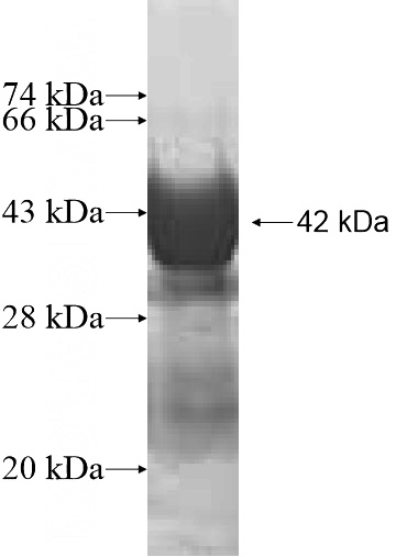 Recombinant Human MED22 SDS-PAGE