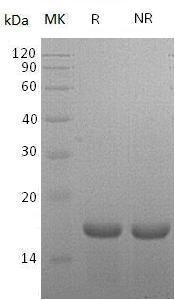 Mouse Il21 (His tag) recombinant protein