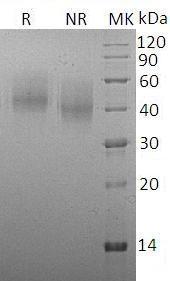 Rabbit CD86 (His tag) recombinant protein