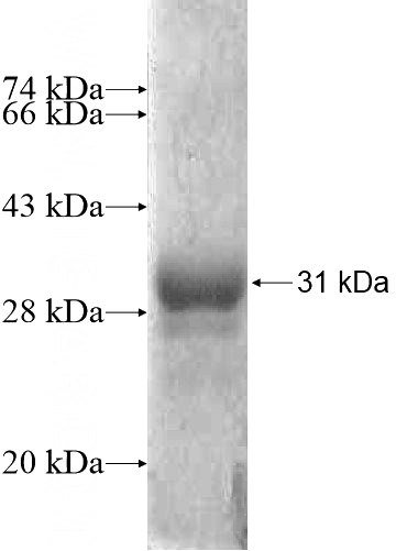 Recombinant Human ARSJ SDS-PAGE