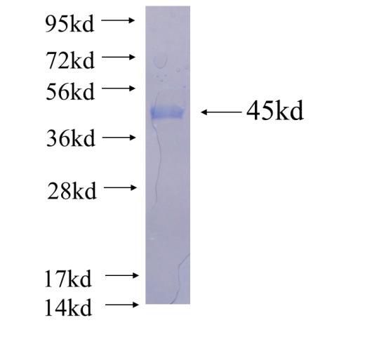 Recombinant human CNRIP1 SDS-PAGE