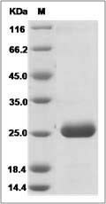 Rat PRL2A1 / Prolactin-2A1 Protein (His Tag)