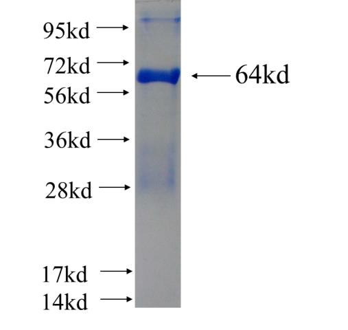 Recombinant human RABGAP1L SDS-PAGE