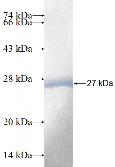 Recombinant Human PSMB2 SDS-PAGE