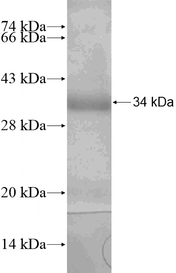 Recombinant Human TMPPE SDS-PAGE