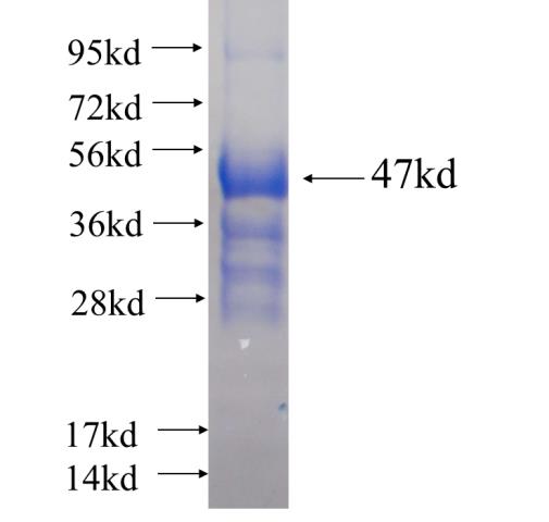 Recombinant human NANOS3 SDS-PAGE