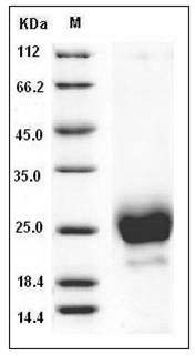 Human WAP5 / WFDC2 / HE4 Protein (His Tag) SDS-PAGE