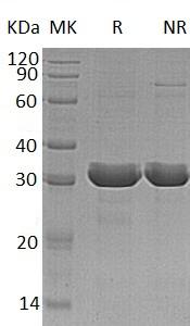 Human HDGFL3/HDGF2/HDGFRP3/CGI-142 (His tag) recombinant protein