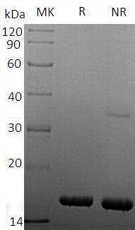Human TNF/TNFA/TNFSF2 (His tag) recombinant protein