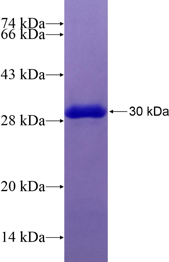 Recombinant Human RDH13 SDS-PAGE