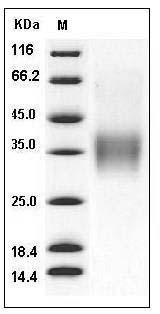 Mouse CD16-2 / FCGR4 Protein (His & AVI Tag) SDS-PAGE