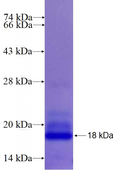 Recombinant Human PCNT SDS-PAGE