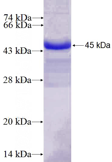 Recombinant Human ANK3 SDS-PAGE
