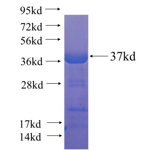 Recombinant human Cyclin D3 SDS-PAGE