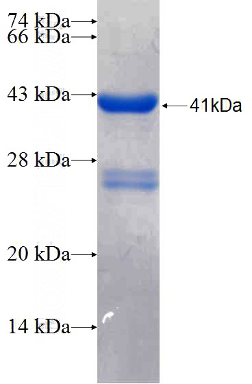 Recombinant Human KIF21A SDS-PAGE