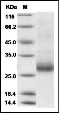 Human RANKL / OPGL / TNFSF11 / CD254 Protein SDS-PAGE