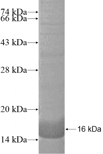 Recombinant Human RDH8 SDS-PAGE