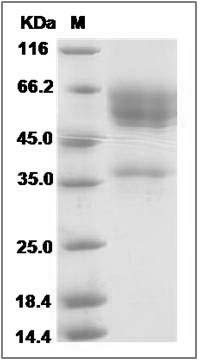 Human NKG2D / CD314 / KLRK1 Protein (Fc Tag) SDS-PAGE