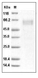Human IL1RL1 / DER4 Protein SDS-PAGE