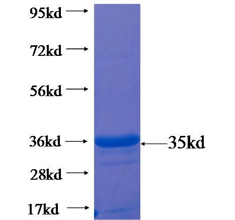 Recombinant human CAPNS1 SDS-PAGE